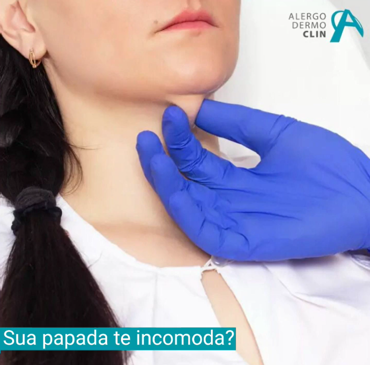 Sua papada te incomoda?